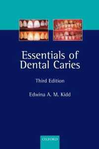 Essentials Of Dental Caries