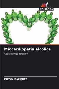 Miocardiopatia alcolica