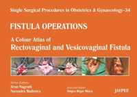 Fistula Operations