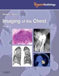 Imaging of the Chest, 2-Volume Set