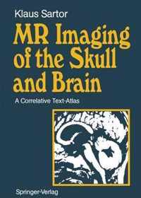 MR Imaging of the Skull and Brain