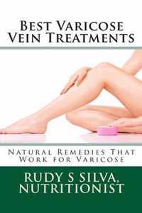 Best Varicose Vein Treatments