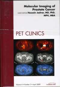 Molecular Imaging of Prostate Cancer, An Issue of PET Clinics