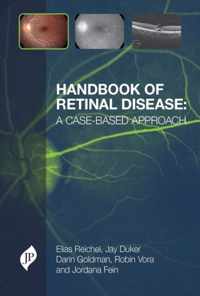 Handbook of Retinal Disease