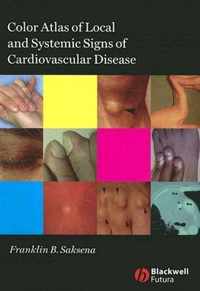 Color Atlas of Local and Systemic Manifestations of Cardiovascular Disease