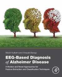 EEG-Based Diagnosis of Alzheimer Disease