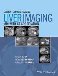 Liver Imaging MRI With CT Correlation