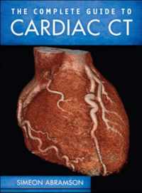 The Complete Guide to Cardiac CT