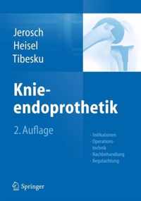 Knieendoprothetik: Indikationen, Operationstechnik, Nachbehandlung, Begutachtung