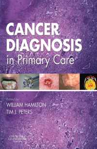 Cancer Diagnosis in Primary Care