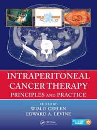 Intraperitoneal Cancer Therapy