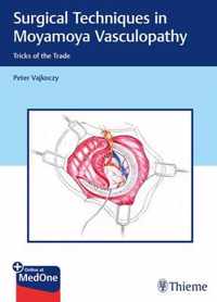 Surgical Techniques in Moyamoya Vasculopathy