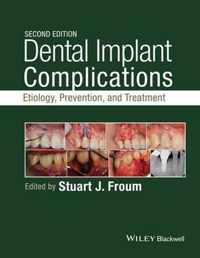 Dental Implant Complications 2nd Edition