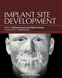 Implant Site Development