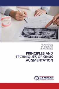 Principles and Techniques of Sinus Augmentation