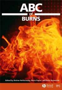 Abc Of Burns