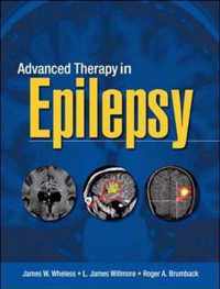 Advanced Therapy in Epilepsy