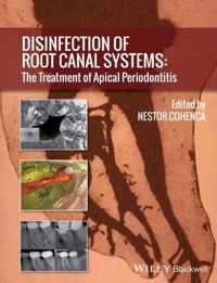 Disinfection Of Root Canal Systems