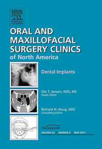 Dental Implants, An Issue of Oral and Maxillofacial Surgery Clinics