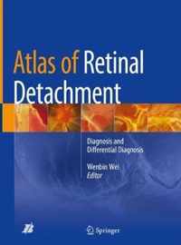 Atlas of Retinal Detachment