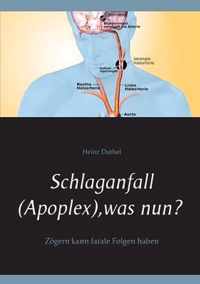 Schlaganfall (Apoplex), was nun?