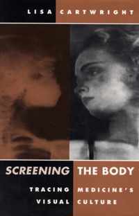 Screening the Body