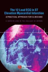 The 12 Lead ECG in ST Elevation Myocardial Infarction