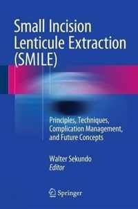 Small Incision Lenticule Extraction (SMILE)