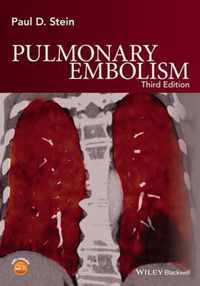 Pulmonary Embolism 3rd Edition