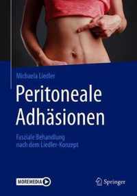 Peritoneale Adhasionen