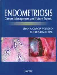 Endometriosis