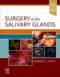 Surgery of the Salivary Glands