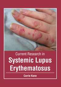 Current Research in Systemic Lupus Erythematosus