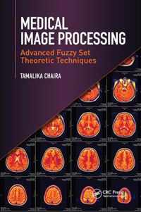 Medical Image Processing: Advanced Fuzzy Set Theoretic Techniques