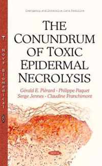 Conundrum of Toxic Epidermal Necrolysis