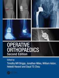 Operative Orthopaedics