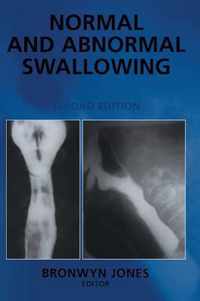 Normal and Abnormal Swallowing