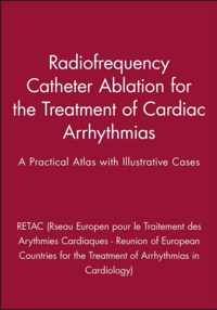 Radiofrequency Catheter Ablation for the Treatment of Cardiac Arrhythmias