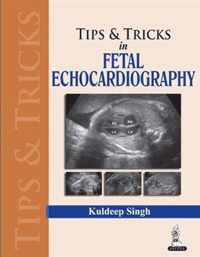 Tips & Tricks in Fetal Echocardiography