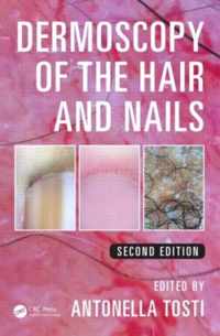 Dermoscopy of the Hair and Nails