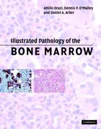 Illustrated Pathology of the Bone Marrow