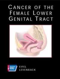 CANCER OF FEMALE LOWER GENITAL TRACT