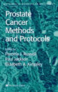 Prostate Cancer Methods and Protocols