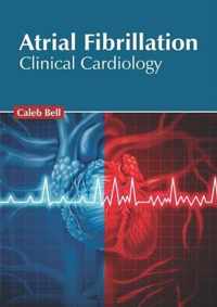 Atrial Fibrillation