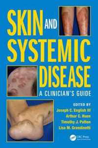 Skin and Systemic Disease: A Clinician's Guide