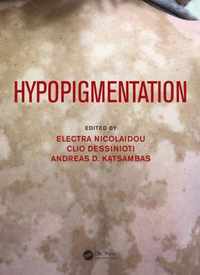 Hypopigmentation