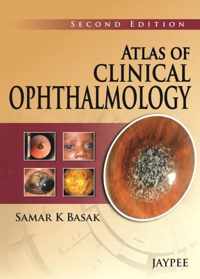 Atlas of Clinical Ophthalmology