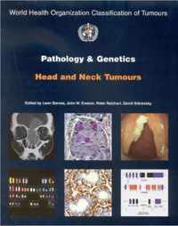 Pathology And Genetics of Head and Neck Tumours