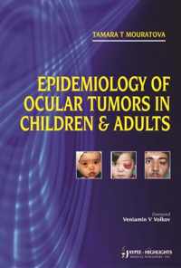 Epidemiology of Ocular Tumors in Children & Adults