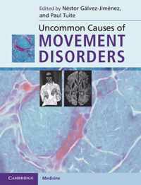 Uncommon Causes Of Movement Disorders